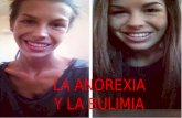 Bulimia & Anorexia