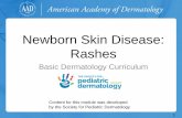 Newborn Skin Disease: Rashes - aad.org