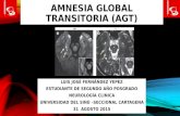 Amnesia global transitoria