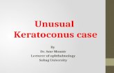 Unusual keratoconus-case