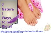7 natural ways to get rid of athlete's foot