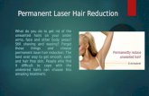 Permanent laser hair reduction