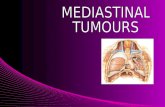 Mediastinal tumours