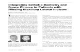 Integrating Esthetic Dentistry and Space Closure in Patients with ...