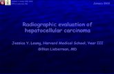 Radiographic evaluation of hepatocellular carcinoma