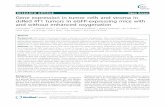 Gene expression in tumor cells and stroma in dsRed 4T1 tumors in ...