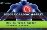 How to treat sudden cardiac arrest