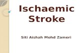 Ischaemic stroke cme