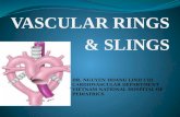 Vascular ring & Sling