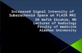 Increased signal intensity of subarachnoid space on FLAIR MRI
