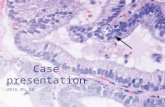 Case presentation -group-14--20160520