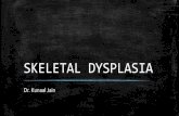 Skeletal dysplasia : Radiodiagnosis