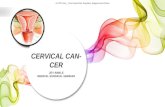 cervical cancer presentation