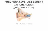 Preoperative assesment in cochlear implantation