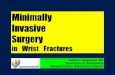 Minimally Invasive Surgery in Wrist Fractures