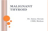 Malignant thyroid