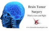 Brain Tumor Surgery In Chennai | Treatment For Brain Cancer In Tamil Nadu