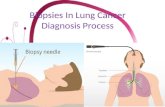 Biopsies in lung cancer diagnosis process