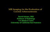 120 mr imaging for the evaluation of carotid atherosclerosis