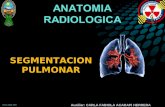 segmentacion pulmonar