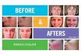 Rodan and Fields Before and Afters