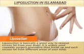 Liposuction in islamabad