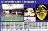 Miocardiopatia chagasica
