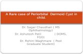 A Rare Case Of Periorbital  Dermoid Cyst In Child