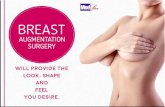 Breast augmentation in delhi
