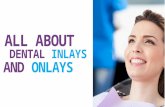 All About Dental Inlays and Onlays