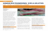 Review Review UNDERSTANDING CELLULITIS OF THE · PDF filePatients with leg ulceration are at risk of developing cellulitis, a potentially life-threatening bacterial ... secondary care