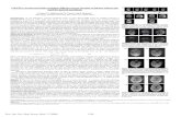 GRAPPA-accelerated high-resolution diffusion tensor ...cds.ismrm.org/protected/09MProceedings/files/01238.pdf · GRAPPA-accelerated high-resolution diffusion tensor imaging of ...