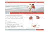 03 Tratamiento de los c lculos renales y · PDF fileInformación a pacientes - Tratamiento de los cálculos renales y ureterales Página 2 / 11 Cólico renal agudo El cólico renal