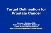 Target Delineation for Prostate Cancer - NYP. · PDF fileTarget Delineation for Prostate Cancer Michael J Zelefsky M.D. Professor of Radiation Oncology Chief, Brachytherapy Service