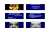 Radiología de Abdomen -  · PDF filePartes blandas, músculos (pared, líneas del psoas) Siluetas viscerales 9Riñones, hígado, bazo, vejiga ... Dolor abdominal con