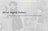 Atrial Septal Defect - SUNY Downstate Medical · PDF fileHPI: 70F . with an Atrial Septal Defect (ASD), referred for elective repair by her cardiologist. Symptoms included . recurrent