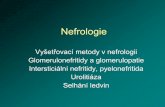 Nefrologie - is.muni.cz · PDF fileNefrologie Vyšetřovací metody v nefrologii Glomerulonefritidy a glomerulopatie Intersticiální nefritidy, pyelonefritida Urolitiáza Selhání