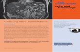 Falk Gastro-Kolleg Leber und Gallenwege · PDF fileFragebeantwortung unter Falk Gastro-Kolleg 1 Titelbild: MRT der Leber (T2­Wichtung): Hepatozelluläres Karzinom Abklärung eines