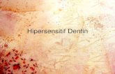 Hipersensitif Dentin - fkg.usu.ac.idfkg.usu.ac.id/images/Bahan_Kuliah/BLOK_10/Hipersensitif_Dentin-drg... · disebabkan oleh aplikasi larutan hipertonis ... Pemberian fluor ... bahan-