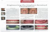 sterngold.comsterngold.com/sterngold/Docs/MASSAD DENT TODAY SEPT2009.pdf · REMOVABLE PROSTHODONTICS ... prove retention of prosthesis. In many in- stances, in an effort to help the
