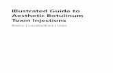 Illustrated Guide to Aesthetic Botulinum Toxin · PDF fileIllustrated Guide to Aesthetic Botulinum ... the two-chain neurotoxin itself, ... ACh binds to the post-synaptic ACh receptors