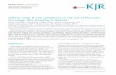 Diffuse Large B-Cell Lymphoma in the Era of Precision ... · PDF fileCentre, Mumbai 400026, India Diffuse large B cell lymphoma ... at various stages of disease treatment including