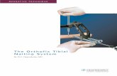 The Orthofix Tibial Nailing System - · PDF fileThe Orthofix Tibial Nailing System By W.C. Oppenheim, MD ... Check for Fracture Distraction ... until the P mark is level with the front