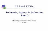 12 Lead ECGs: Ischemia, Injury & Infarction Part 2centegra.org/wp-content/uploads/2013/06/12-Lead-Ischemia-Injury...12 Lead ECGs: Ischemia, Injury & Infarction. Part 2. McHenry Western