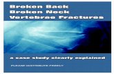 BROKEN NECK, BROKEN BACK, VERTEBRAE FRACTURE Back, Broken Neck , Vertebrae... · A broken back is when one ore more of the lumber or ... can result in spinal cord damage and paralysis,
