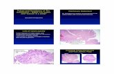 9. Polyps and Neoplasms (2) · PDF fileColon biopsies of colon polyps and neoplasms are common and we will review ... invasive carcinomas. Tubular adenoma with squamous ... Invasive