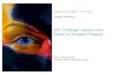OCT Findings: Lesson from Stable vs Unstable Plaques from Stable and Unstable... · OCT Findings: Lesson from Stable vs Unstable Plaques ... SAP vs AMI Infarct Related ... Difference