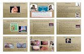 Helping mother’s breastfeed their The Surgeon · PDF fileHelping mother’s breastfeed their ... Revising the upper lip causes “ﬂoppy lips”.!The upper lip is not important