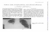 Yellownails, lymphoedema, and pleural effusions - (1966), 21, 247. ... lymphatic drainage. CASEREPORTS CASE 1 Miss M.J., born in 1923, was known from infancy to have had swelling of
