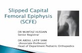 Slipped Capital Femoral Epiphysis (SCFE) - chich.edu.pkchich.edu.pk/wp-content/uploads/ortho-SCFE.pdf · Slipped Capital Femoral Epiphysis (SCFE) DR MUMTAZ HUSSAIN ... 20-50% of SCFE